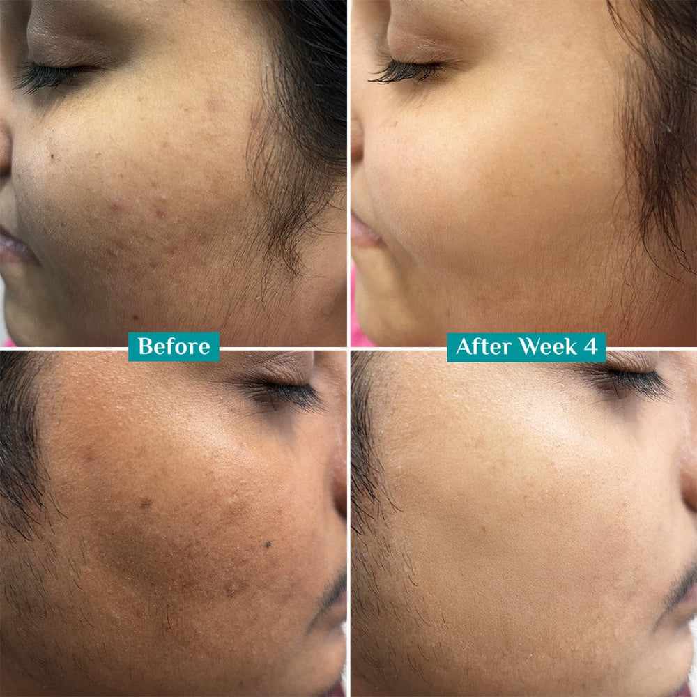 10% Vitamin C Face Serum For Triple Glow+++